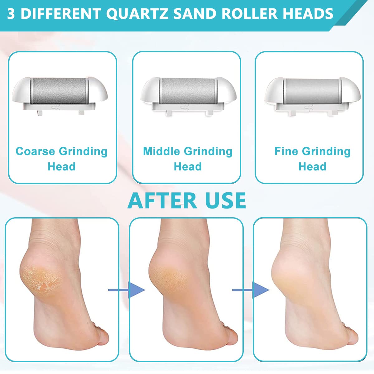 HANNEA Pedicure Scrubber for Smooth Feet with 2 Speeds and LCD Display | Rechargeable 1200mAh Electric Callus Remover