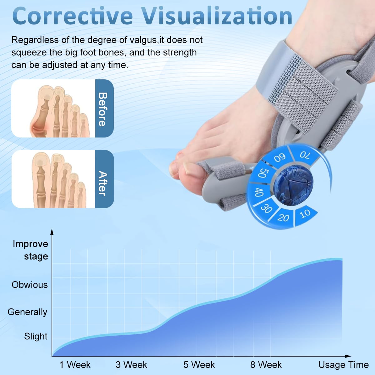 HANNEA Bunion Corrector for Women and Men featuring 180° Adjust Knob with Silicone Pad | Grey Orthopedic Toe Straightener