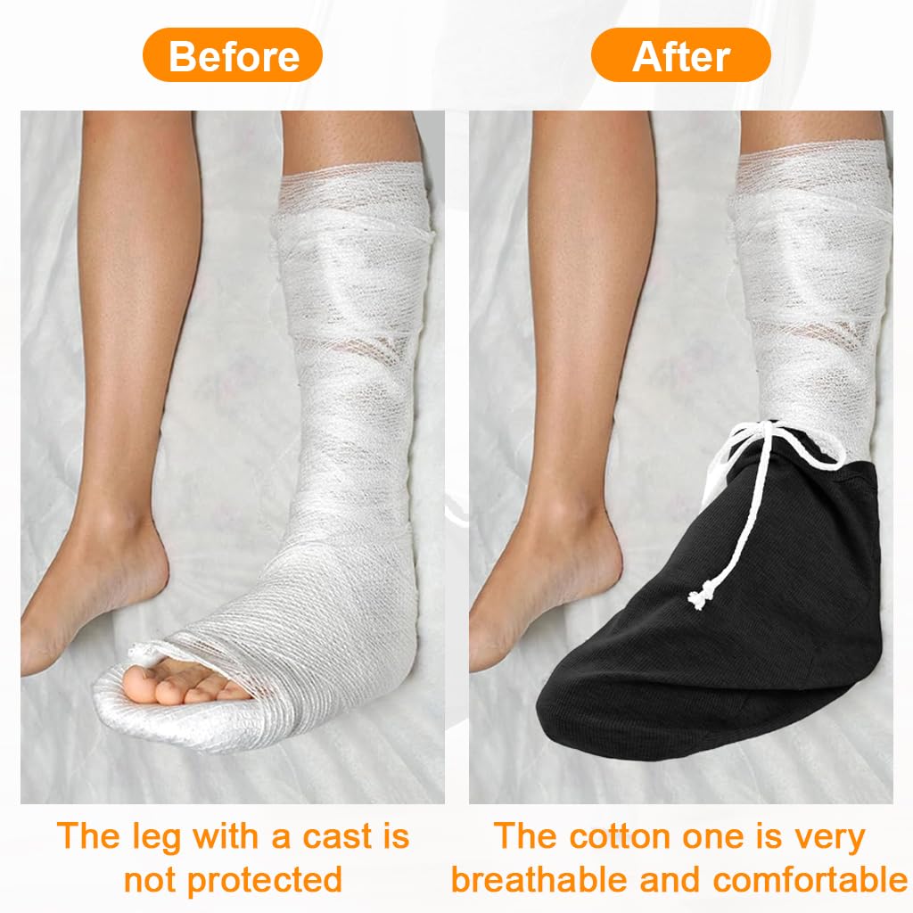 HANNEA Warm Cast Socks for Bandaged or Injured Feet with Drawstring Closure | Soft Protective Foot Sleeves