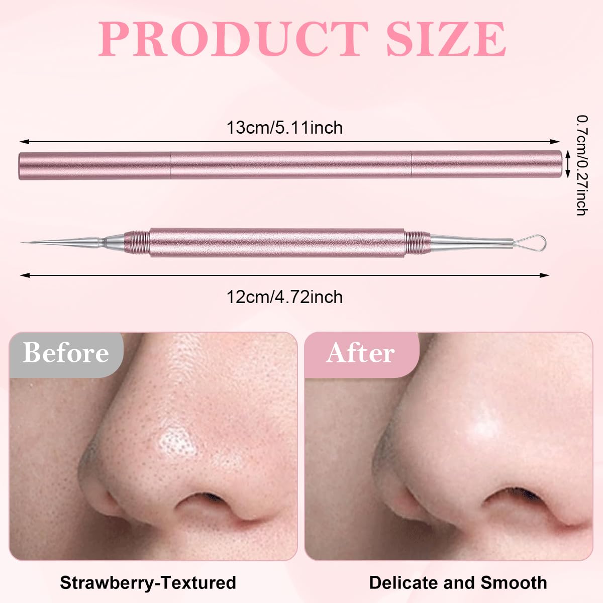 ZIBUYU Blackhead Remover Tool for Acne Extraction with Dual Head 2 in 1 Stainless Steel