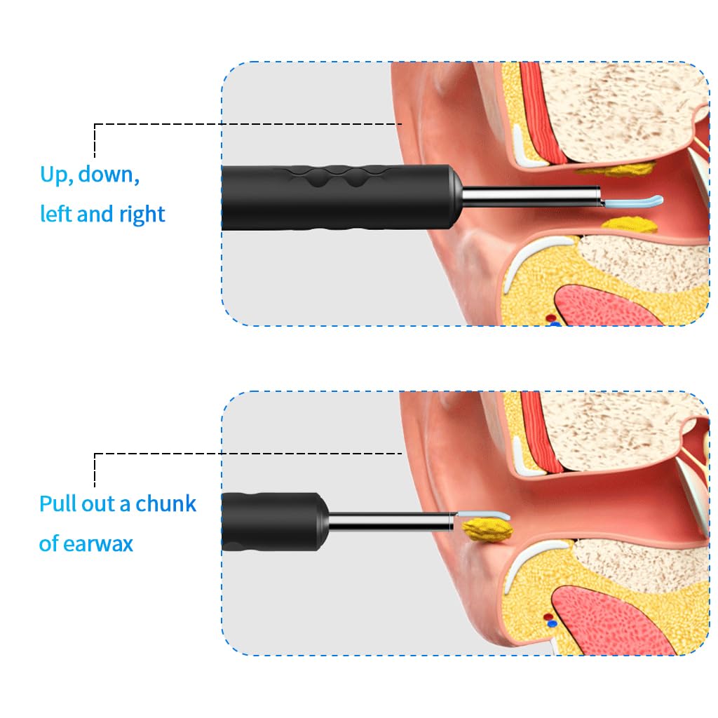 HANNEA Ear Wax Remover Tool Kit for iOS & Android with 1080P HD Camera and 6 LED Lights