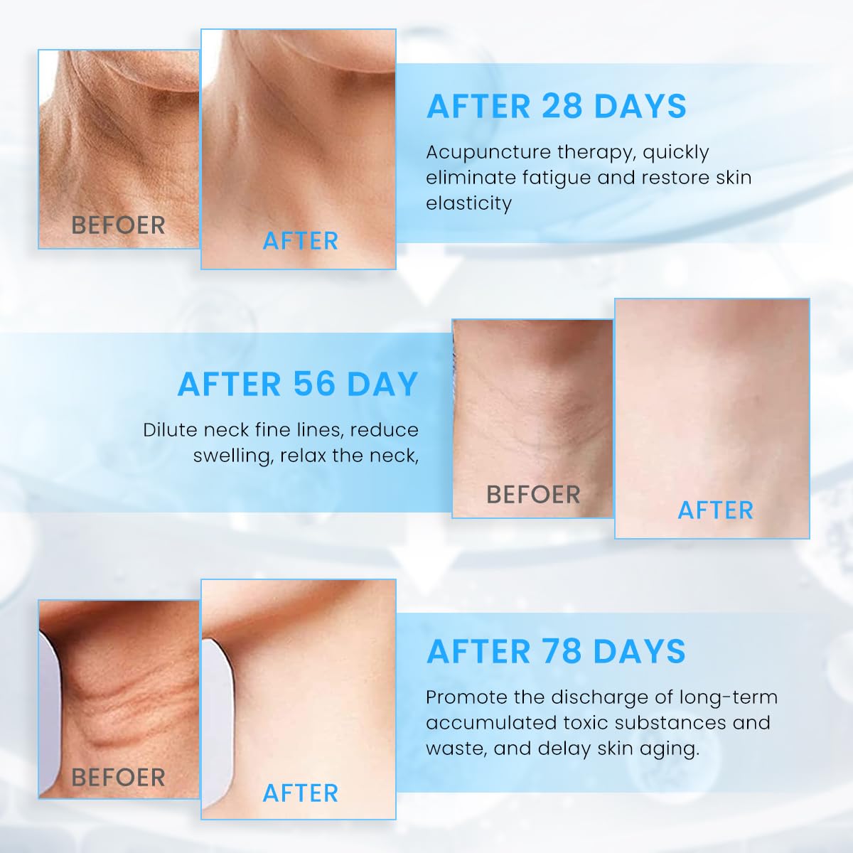 HANNEA EMS Beauty Machine for Neck and Face with 3 Light Modes and 500mAh Rechargeable Battery