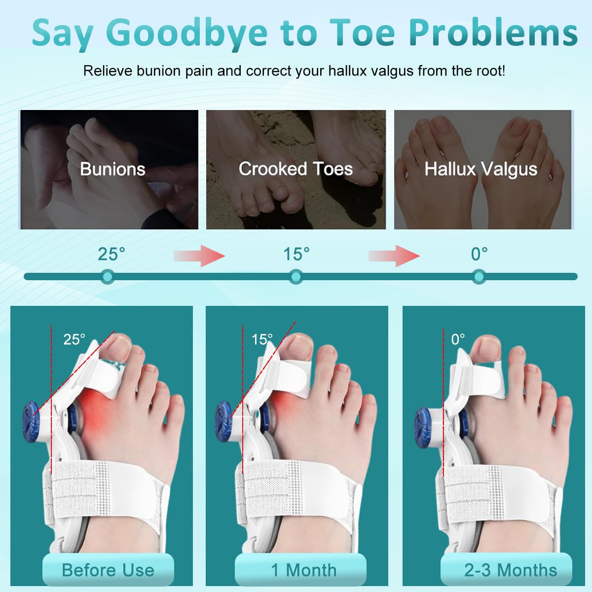 HANNEA Bunion Corrector for Women and Men featuring Adjustable Knob Traction with Silicone Pad | Comfortable Orthopedic Toe Straightener