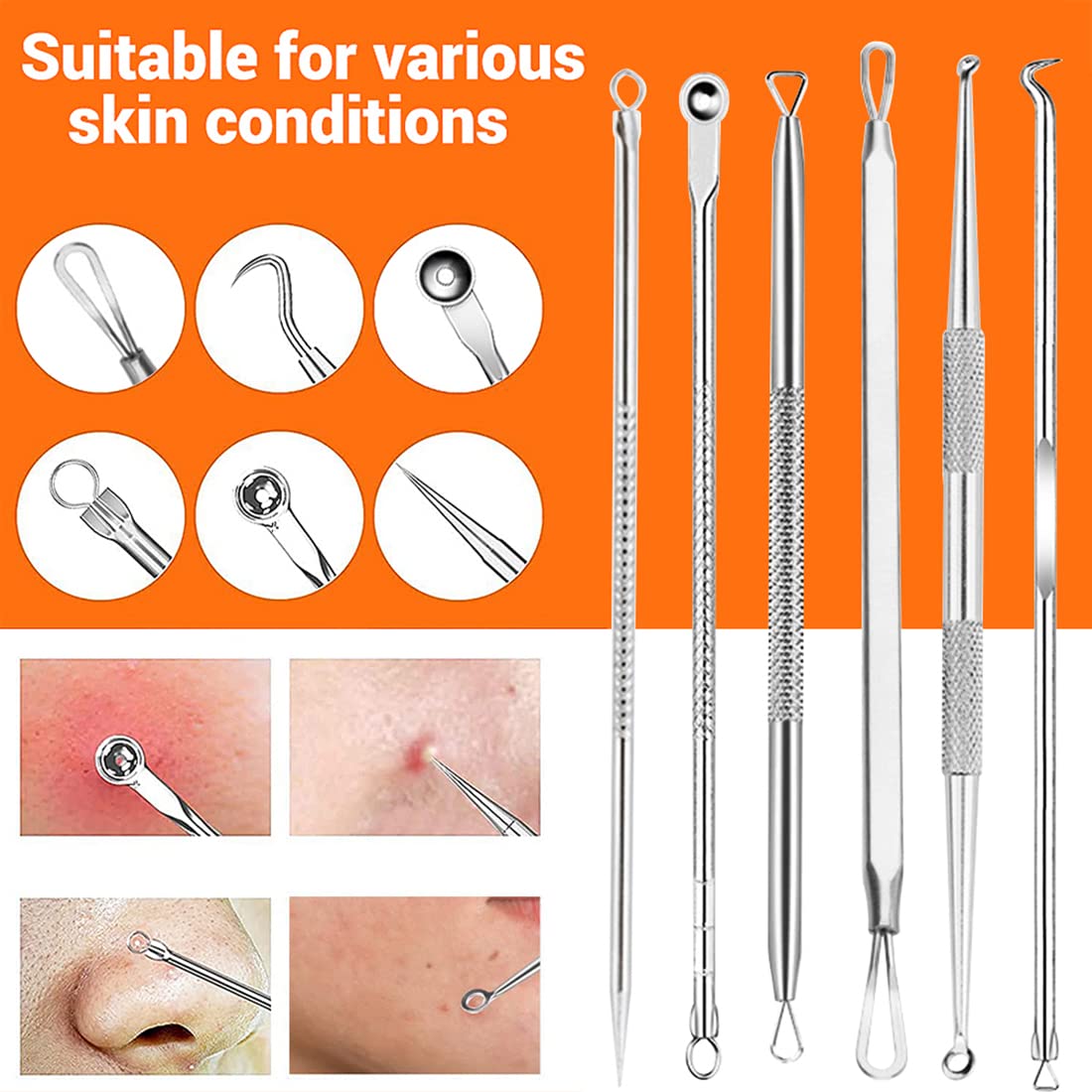 MAYCREATE® 9PCS Blackhead Remover Tools Stainless Steel Blackhead Pimple Blemish Extractor/Remover Tool with Tweezers, Professional Acne Remove Tools