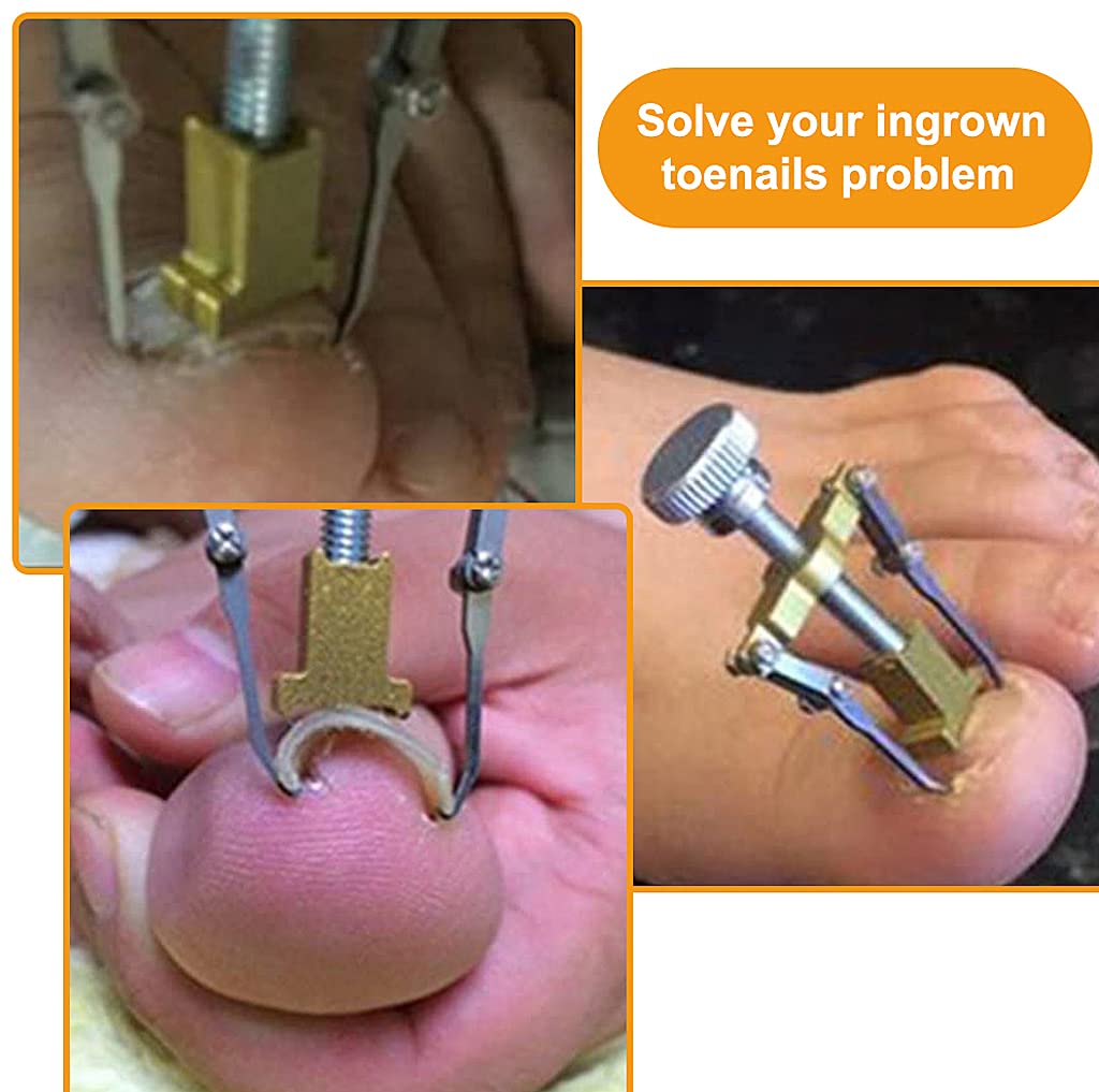 HASTHIP Nail Clippers for Ingrown and Thick Toenails with Lever Action and Stainless Steel | Professional Pedicure Tools Kit