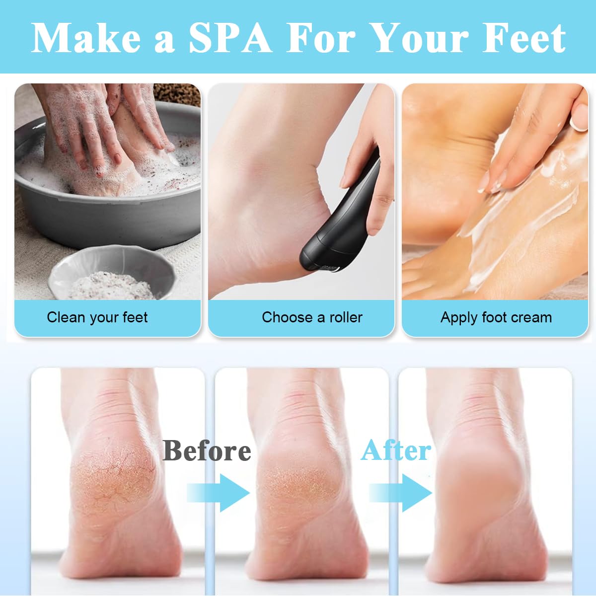 MAYCREATE Electric Callus Remover for Feet with 3 Speeds and 3 Grinding Heads | USB Rechargeable