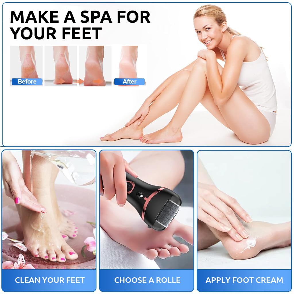 HANNEA Electric Callus Remover for Feet with 3 Grinding Heads and LCD Display | 2 Speed Rechargeable Pedicure Tool