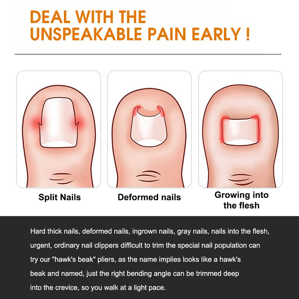 MAYCREATE Ingrown Toenail Correction Tool for Thick Nails with Curved Blade & Ergonomic Handle | Stainless Steel Clippers Set with 4 Nail Care Tools and Storage Case