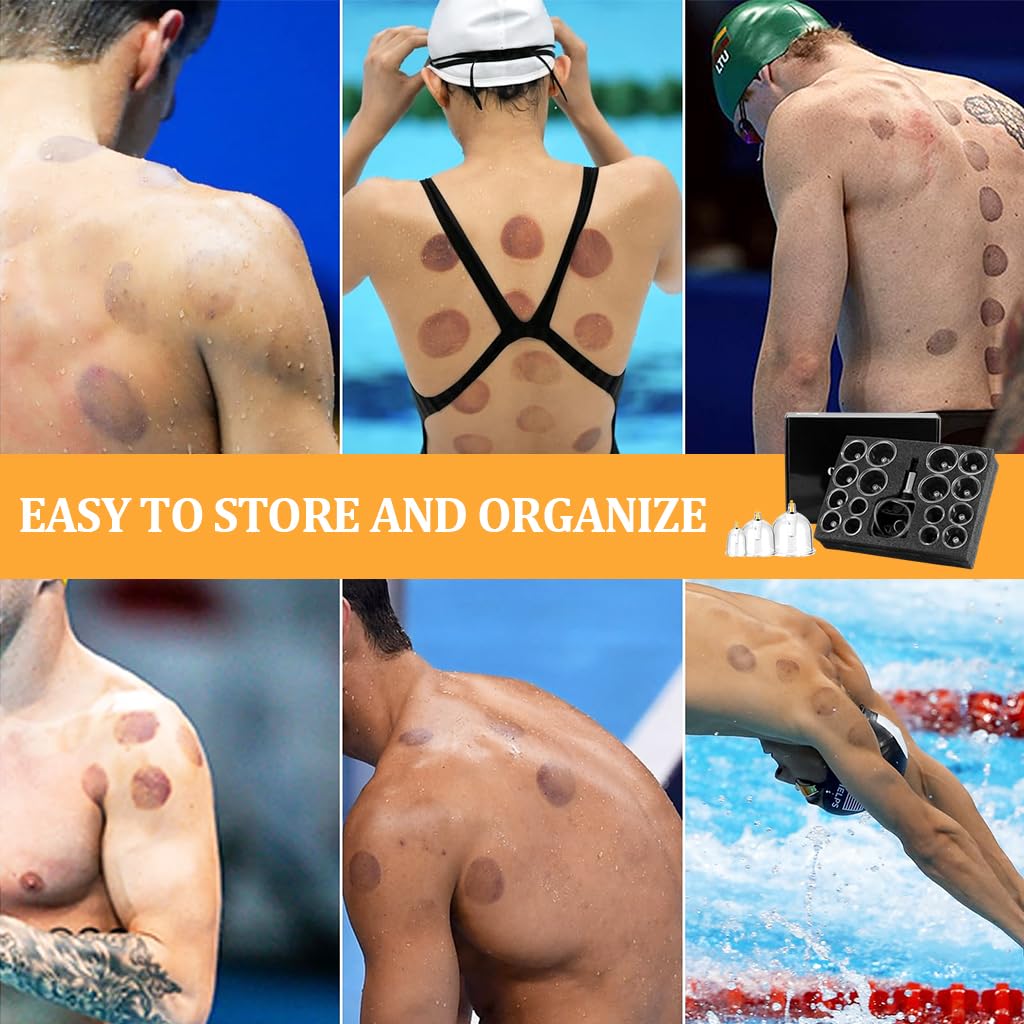 HANNEA Vacuum Cupping Kit for Pain Relief with Manual Pump and Assorted Silicone Cups | Home Therapy