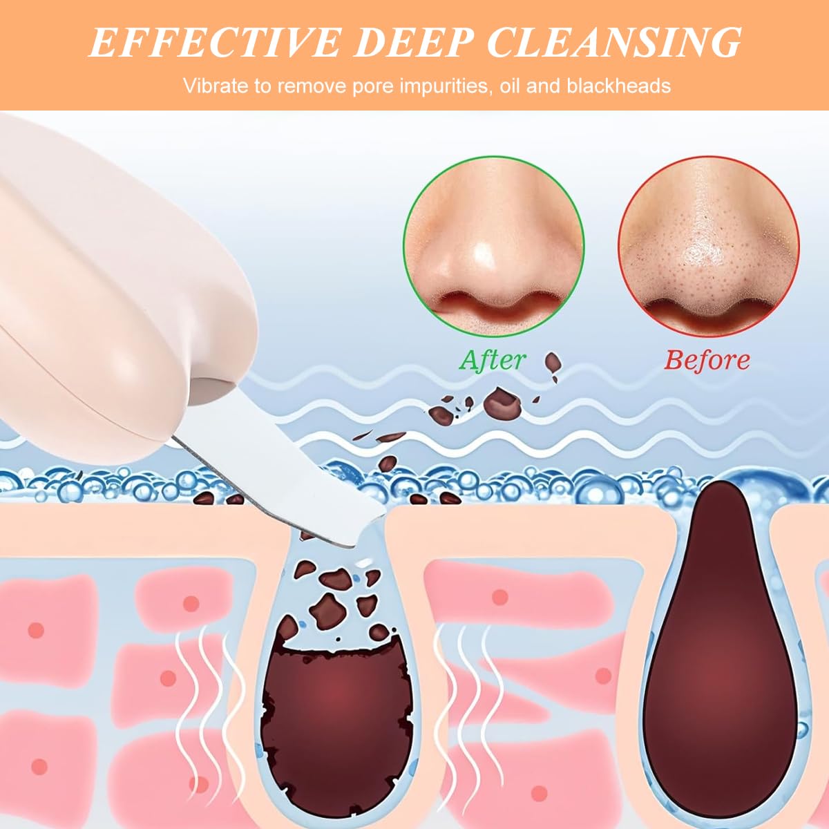 MAYCREATE Blackhead Remover Tool for Deep Cleansing with Heart Shaped Handle | 2 PCS Stainless Steel