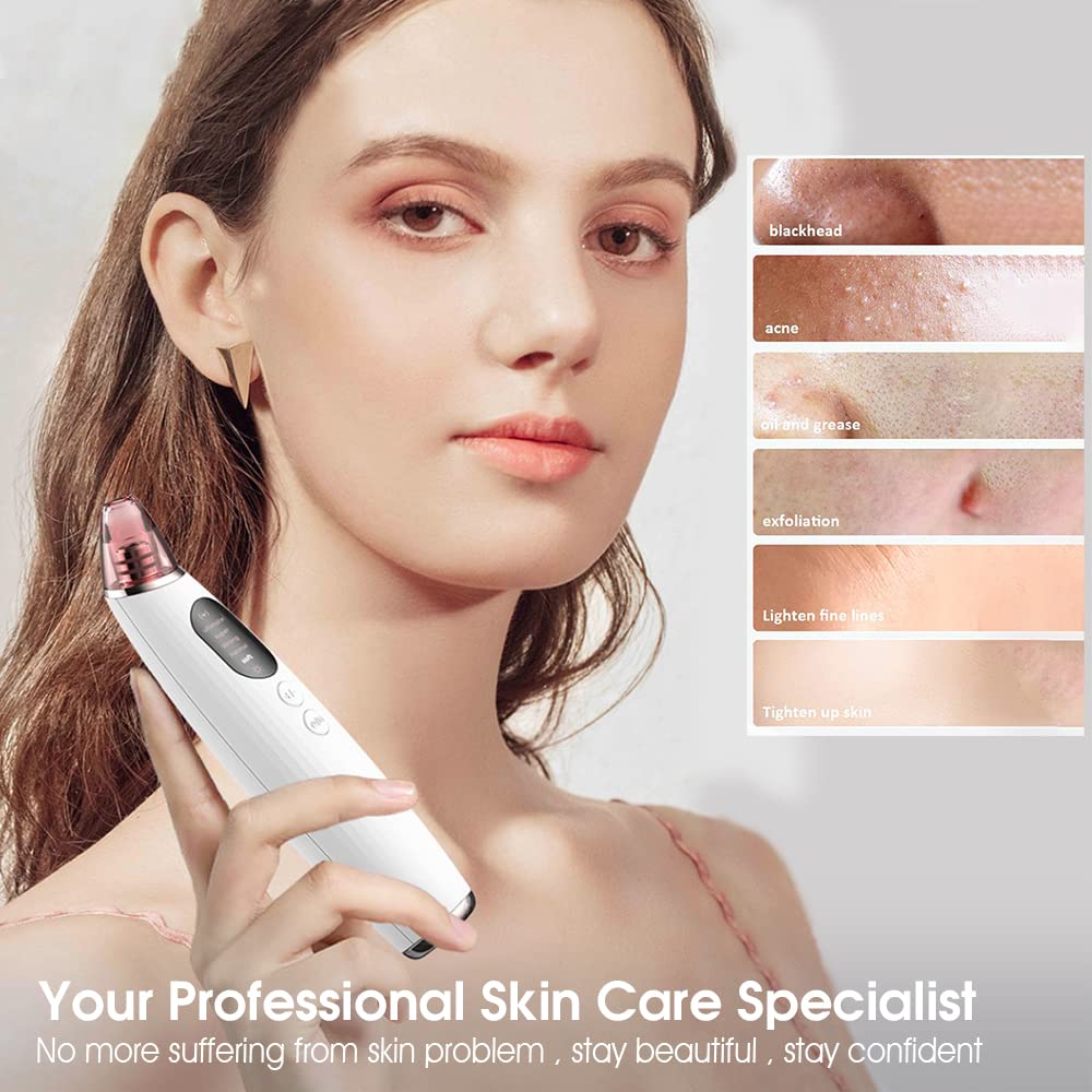MAYCREATE Blackhead Remover Pore Vacuum for Facial Cleansing with 60Kpa Suction and Heat Compress | USB Rechargeable Tool for Women
