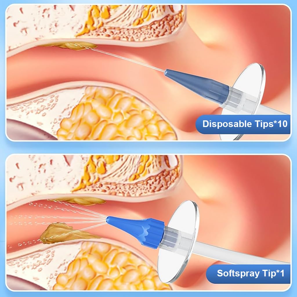 HANNEA Manual Ear Irrigator for Gentle Ear Wax Removal with 10 Nozzles and 250ml Cup | Safe for Adults and Kids