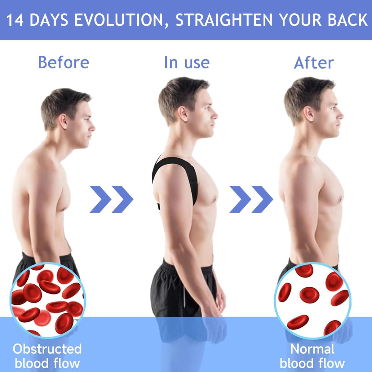 Zibuyu Posture Corrector for Women and Men with Adjustable Straps and Breathable Mesh | XL Back Brace for Shoulder and Spine Alignment