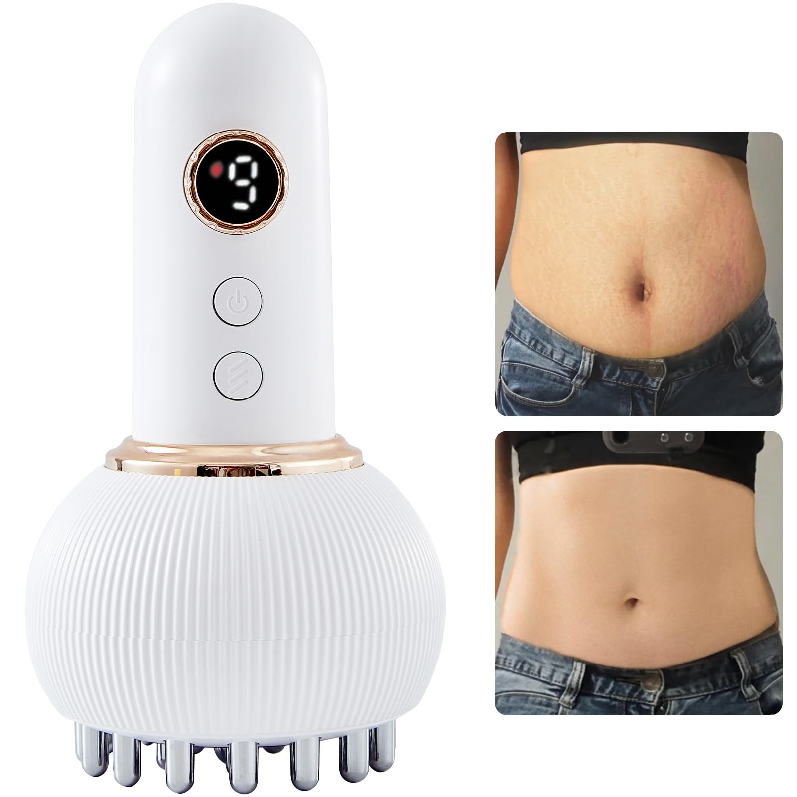 [Second-hand]HANNEA@ Lymphatic Drainage Massager & Anti-Cellulite Tool for Legs, Arms, Belly Sculpting Machine with Microcurrent, Light, Heat, Vibration Reduces Stretch Marks Rechargeable White