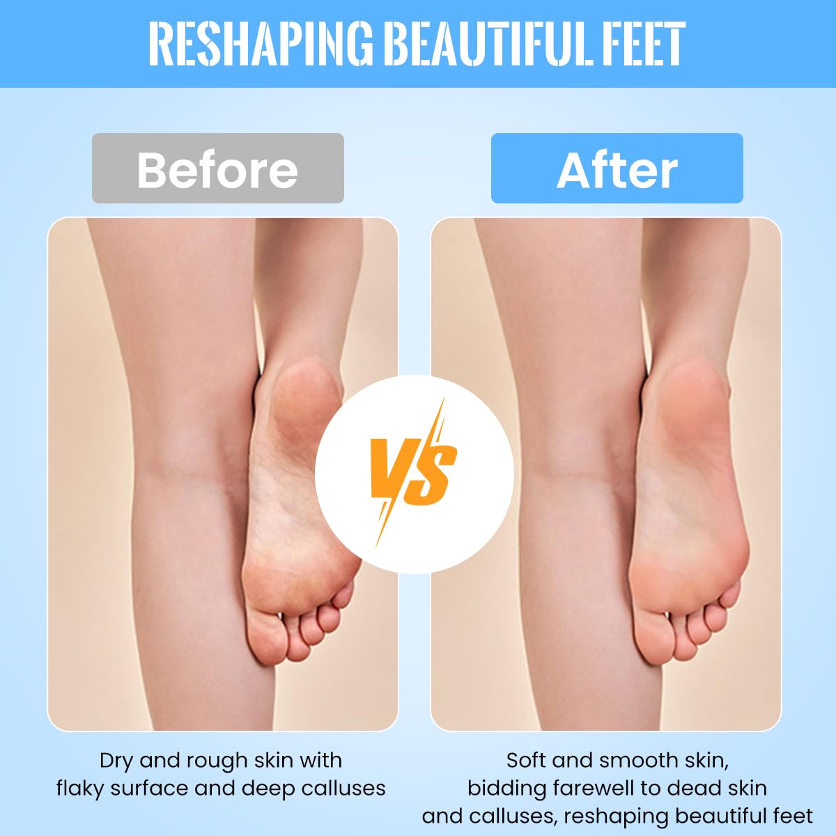 ZIBUYU Foot Scrubber for Dead Skin Removal with 3 Rollers and Rechargeable Pedicure Machine | Home Spa Care