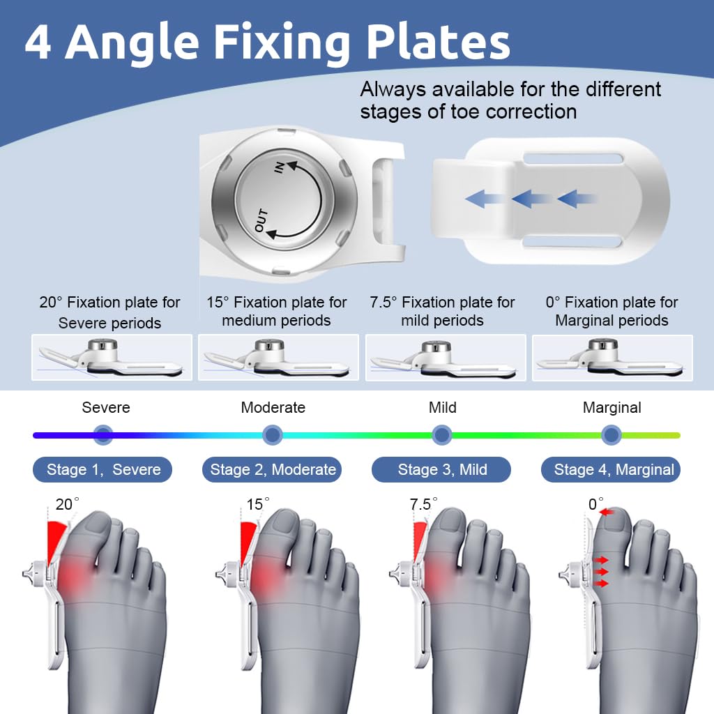 HANNEA Bunion Corrector for Pain Relief with 6 Adjustable Tension and Knob Alignment | Toe Splint for Women and Men