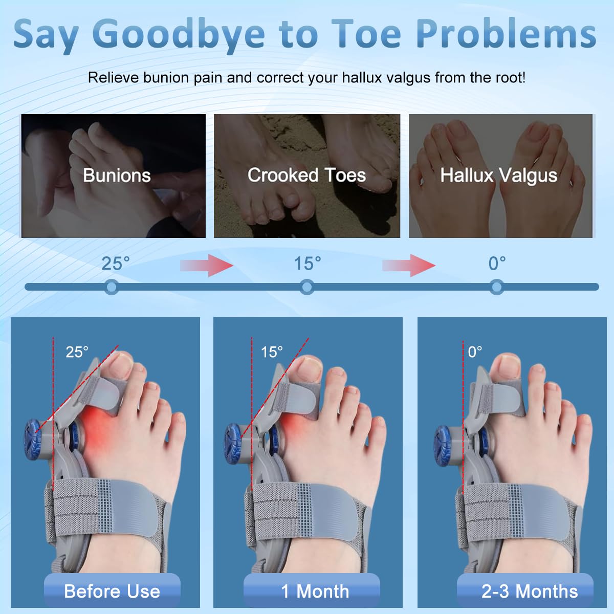 HANNEA Bunion Corrector for Women and Men featuring 180° Adjust Knob with Silicone Pad | Grey Orthopedic Toe Straightener