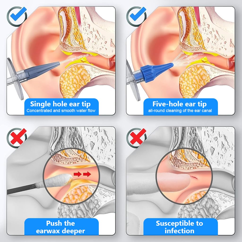 HANNEA Manual Ear Rinser Kit for Ear Cleaning with 30 Nozzles and Long Flexible Tube | Adults & Kids
