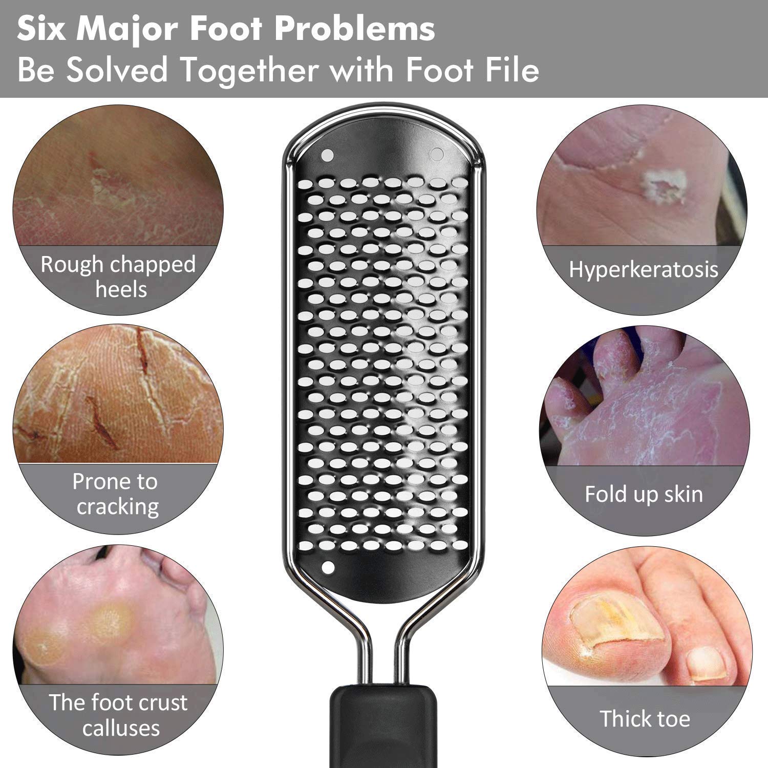ZORBES Stainless Steel Rasp Callus Filer for Wet and Dry Feet with Easy Clean 3PCS | Smooth Heel Care
