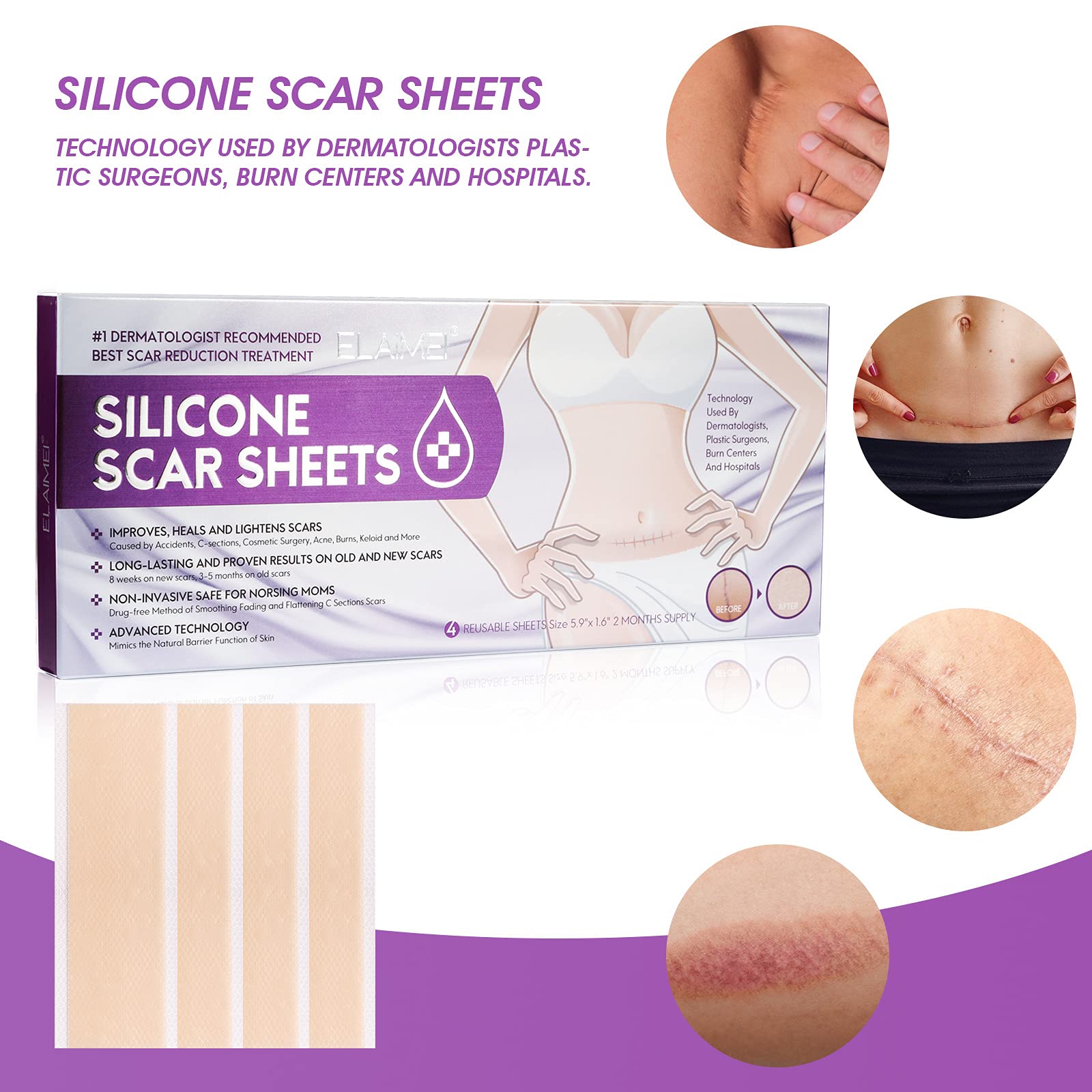 HANNEA® Medical Soft Silicone Gel Tape for Scar Removal, Tear Silicone Tape Roll, For Hypertrophic Scars and Keloids Caused by Surgery, Pain-Free Removal, Water-proof(1.6