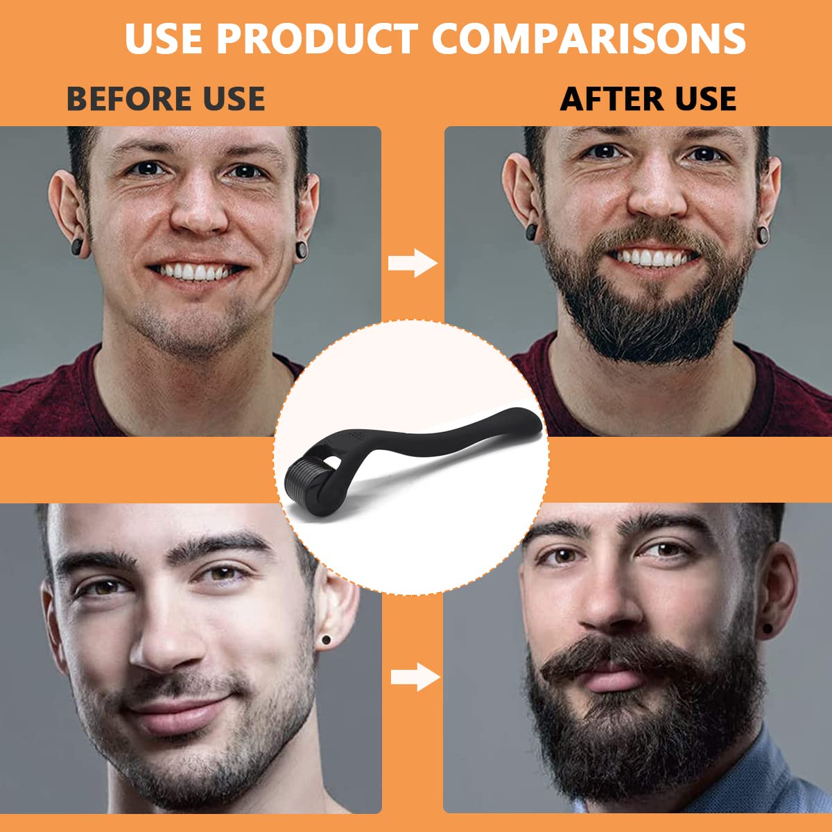 FANCYKU Beard Roller for Facial Hair Growth with 0.5mm 540 Titanium Needles & Ergonomic Handle