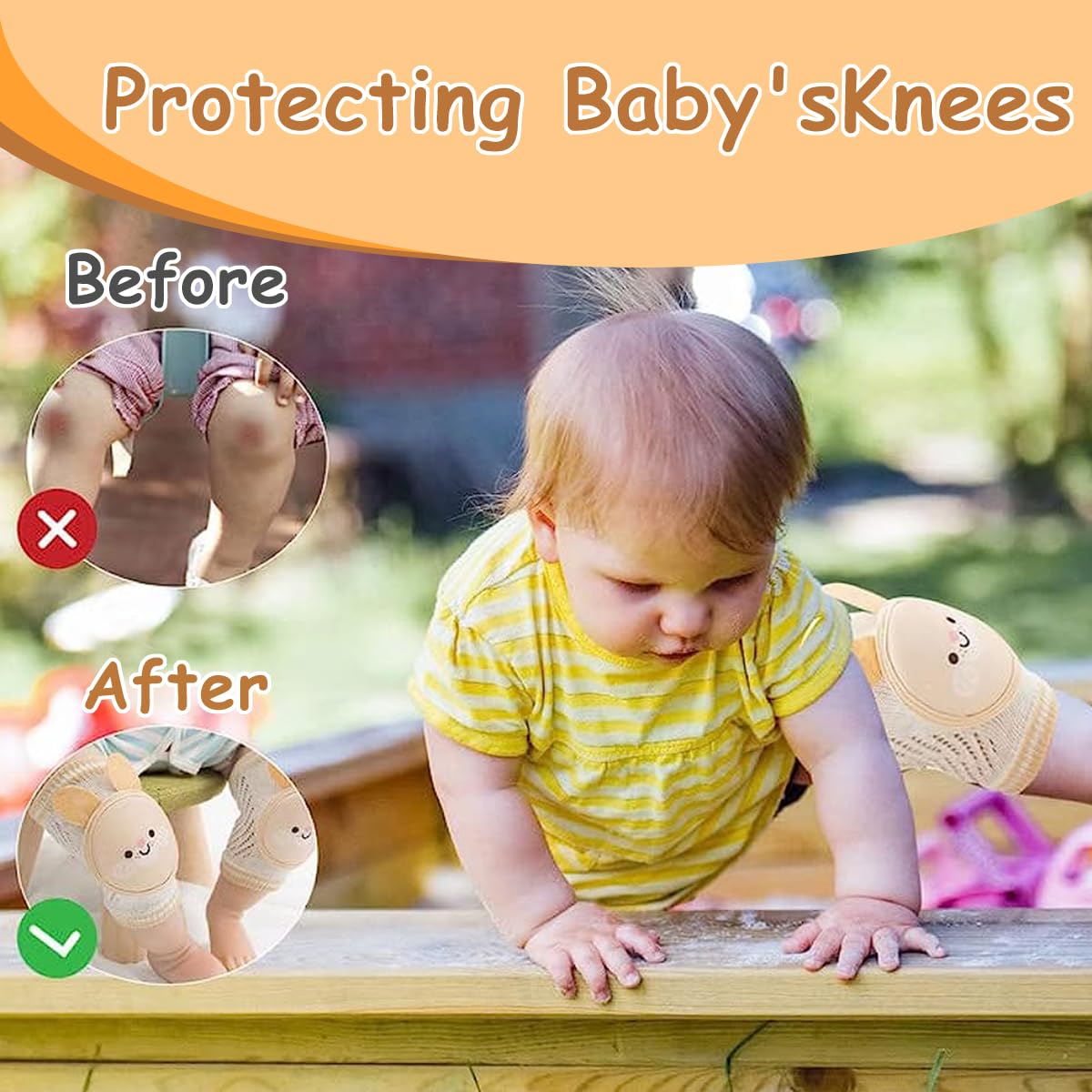 SNOWIE SOFT Baby Knee Pads for Crawling with Anti Slip Elastic Sleeve | 2 Pair Breathable Protection for Infants Toddlers