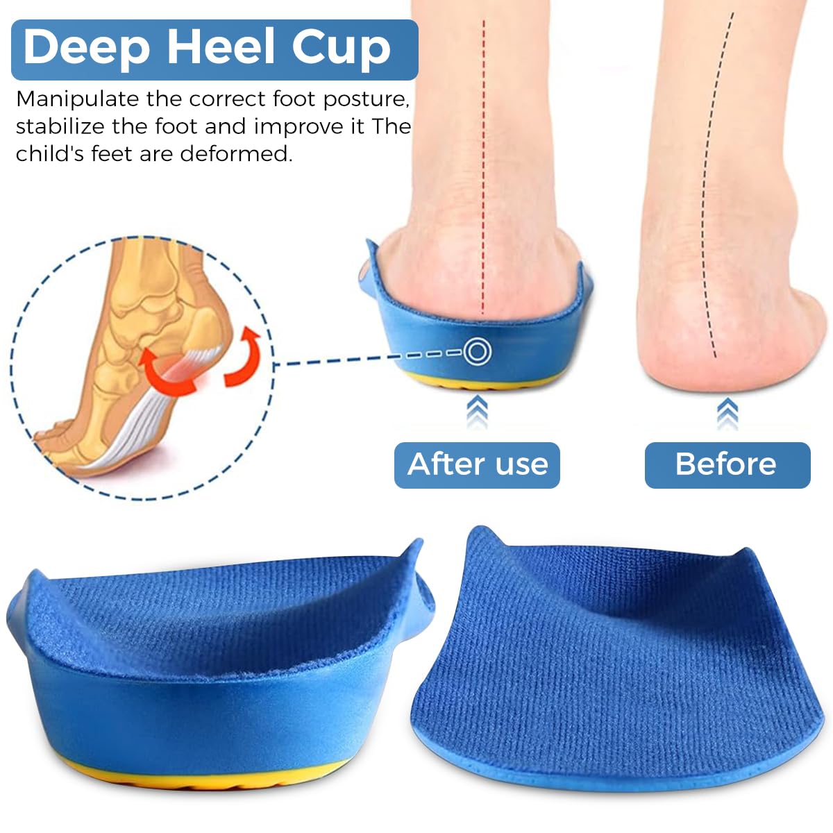 ZIBUYU Orthotic Cushioning Arch Support Shoe Insoles, Pu Foam Inserts for Flat feet, Plantar Fasciitis, Feet Heel Pain Relief, Blue
