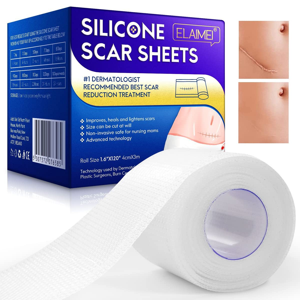 HANNEA® Silicone Scar Sheets, Silicon gel sheets for Scars Transparent Medical Silicone Gel Tape for Scar Removal, Silicone Scar Tape Roll For Hypertrophic Scars and Keloids Caused by Surgery