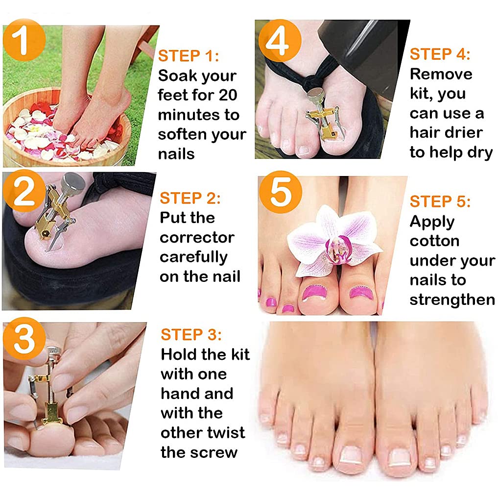 HASTHIP Nail Clippers for Ingrown and Thick Toenails with Lever Action and Stainless Steel | Professional Pedicure Tools Kit