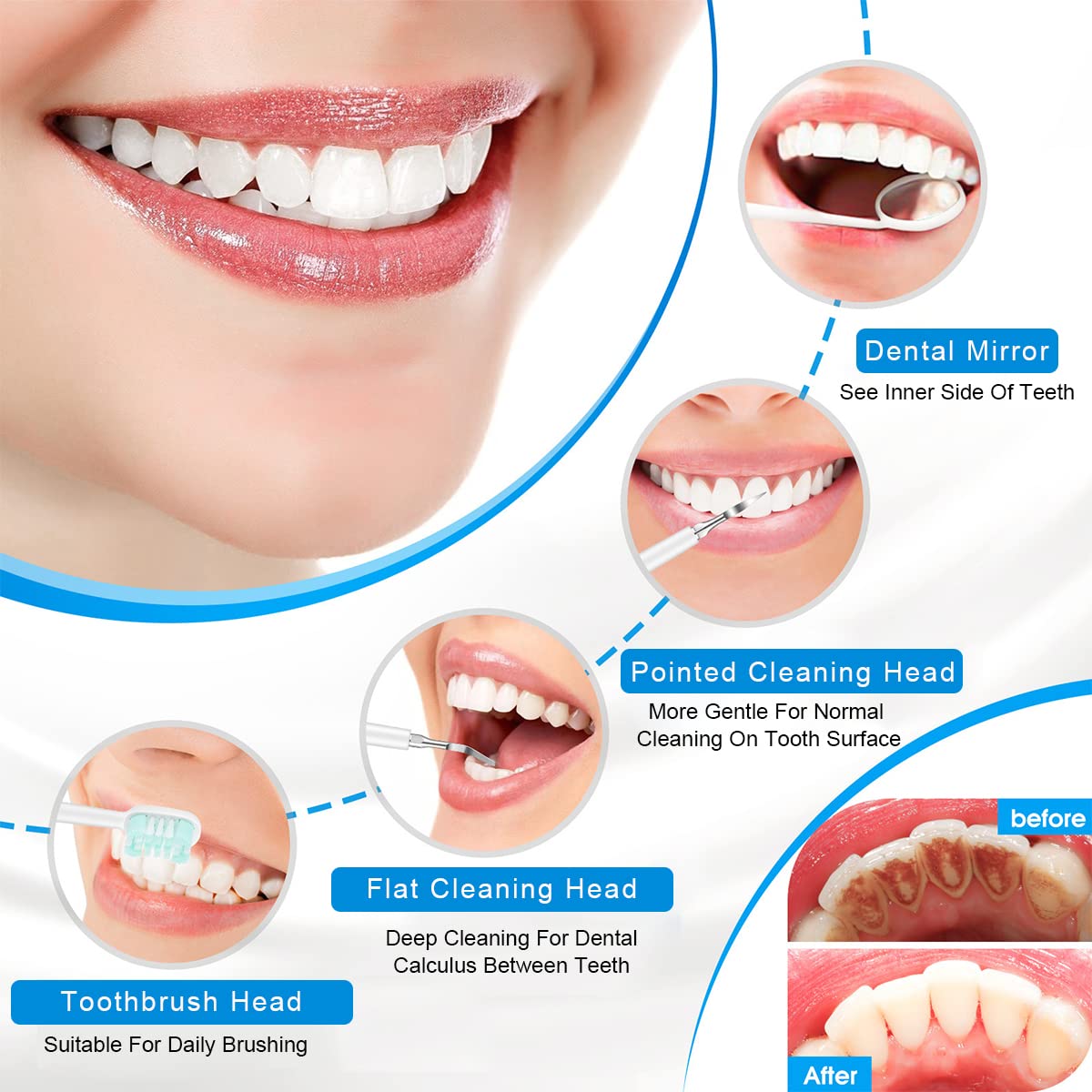 HANNEA Teeth Cleaning Kit for Home Dental Care with 5 Modes and IPX7 Waterproof Design