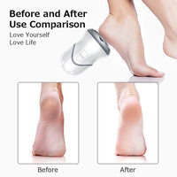 MAYCREATE  Callous Remover Electric USB Rechargeable Foot Callus Remover Pedicure Dead Skin Remover Foot Scrubber for Women Dead Skin Foot Care Tool Cracked Heels Remover Tools