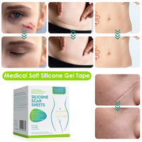 HANNEA  Medical Soft Silicone Gel Tape for Scar Removal, Tear Silicone Tape Roll, For Hypertrophic Scars and Keloids Caused by Surgery, Pain-Free Removal, Water-proof(1.6  x 60 )